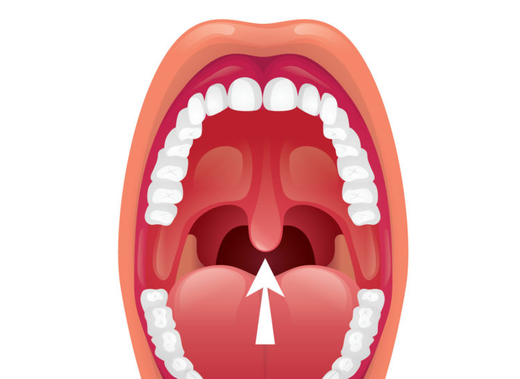 bump-in-back-of-throat-causes-symptoms-and-treatment