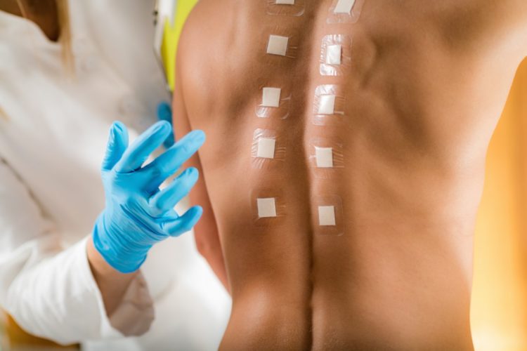 Medical professional doing allergy testing on skin